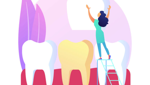 Hal yang Perlu Diperhatikan tentang Mahkota Tiruan Gigi (Dental Crown)